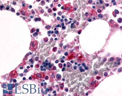 Anti-EMR1 antibody LS-A2675 IHC of human bone marrow. Immunohistochemistry of formalin-fixed, paraffin-embedded tissue after heat-induced antigen retrieval.