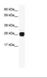 Fetal Skeletal Muscle Lysate
