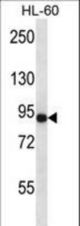 CD97 Antibody western blot of HL-60 cell line lysates (35 ug/lane). The CD97 antibody detected the CD97 protein (arrow).