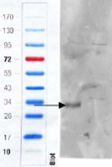 CD97 antibody (1 ug/ml) staining of Mouse Colon (wt, left lane, knock-out right lane) lysate (35 ug protein in RIPA buffer). Primary incubation was 1 hour. Detected by infrared fluorescence (Odyssey). Data obtained from anonymous customer