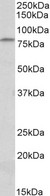 CD97 antibody (0.3 ug/ml) staining of Mouse Thymus lysate (35 ug protein in RIPA buffer). Primary incubation was 1 hour. Detected by chemiluminescence.
