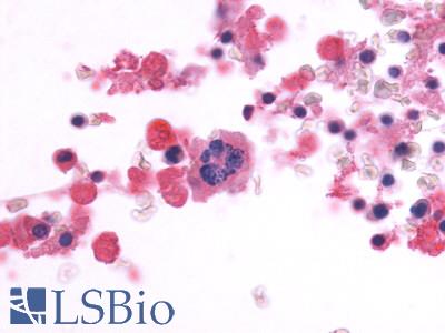 Anti-CD97 antibody LS-A2652 IHC of human bone marrow. Immunohistochemistry of formalin-fixed, paraffin-embedded tissue after heat-induced antigen retrieval.