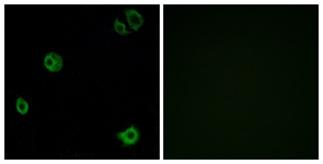 Immunofluorescence of A549 cells, using GPR110 Antibody. The picture on the right is treated with the synthesized peptide.