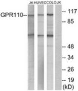 Western blot of extracts from Jurkat/HUVEC/COLO cells, using GPR110 Antibody. The lane on the right is treated with the synthesized peptide.