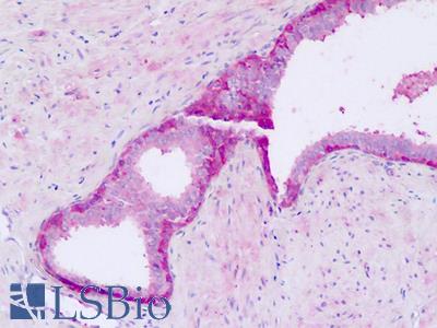 Human, Prostate: Formalin-Fixed Paraffin-Embedded (FFPE)