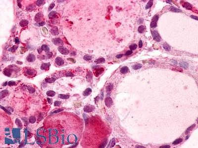 Anti-GPR56 antibody IHC of human thyroid. Immunohistochemistry of formalin-fixed, paraffin-embedded tissue after heat-induced antigen retrieval. Antibody LS-A1214 dilution 4-32 ug/ml.