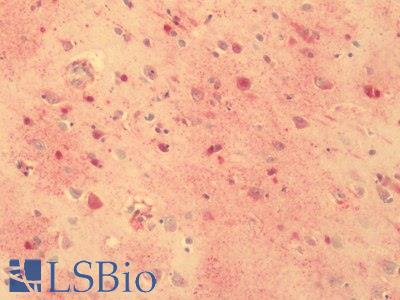 Human, Brain: Formalin-Fixed Paraffin-Embedded (FFPE)