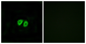 Immunofluorescence of MCF7 cells, using GPR56 Antibody. The picture on the right is treated with the synthesized peptide.