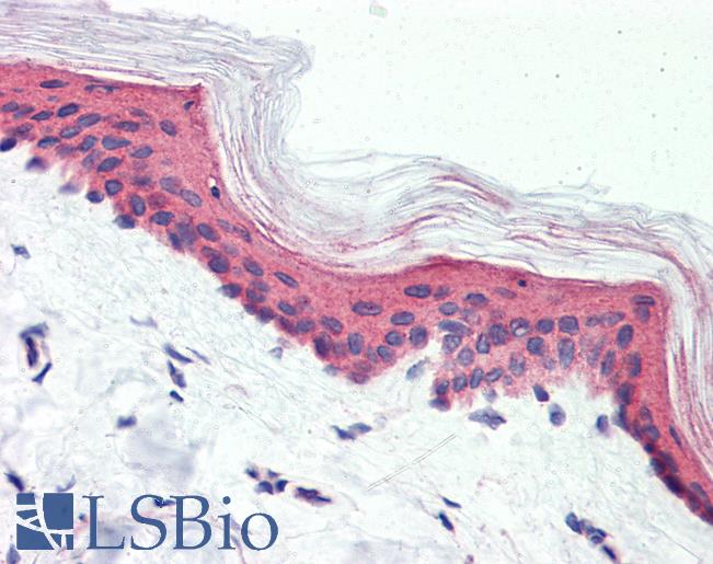 Anti-GPR126 antibody LS-A4882 IHC of human skin. Immunohistochemistry of formalin-fixed, paraffin-embedded tissue after heat-induced antigen retrieval.