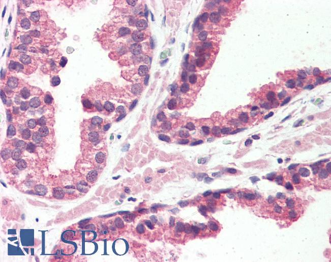 Anti-GPR126 antibody LS-A4882 IHC of human prostate. Immunohistochemistry of formalin-fixed, paraffin-embedded tissue after heat-induced antigen retrieval.