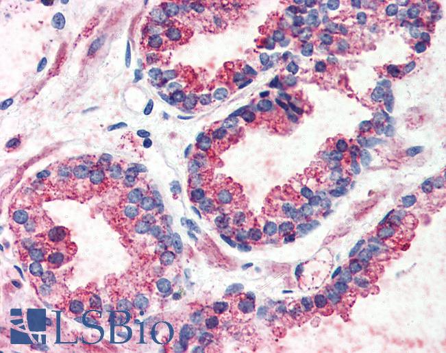 Anti-GPR126 antibody LS-A4885 IHC of human prostate. Immunohistochemistry of formalin-fixed, paraffin-embedded tissue after heat-induced antigen retrieval.
