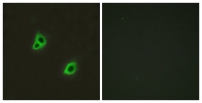 Immunofluorescence of HUVEC cells, using GPR126 Antibody. The picture on the right is treated with the synthesized peptide.