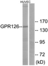 Western blot of extracts from HUVEC cells, using GPR126 Antibody. The lane on the right is treated with the synthesized peptide.