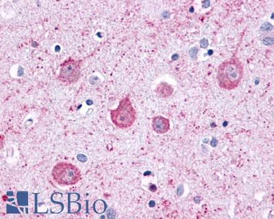 Anti-LPHN2 antibody LS-A1136 IHC of human brain, neurons and glia. Immunohistochemistry of formalin-fixed, paraffin-embedded tissue after heat-induced antigen retrieval.