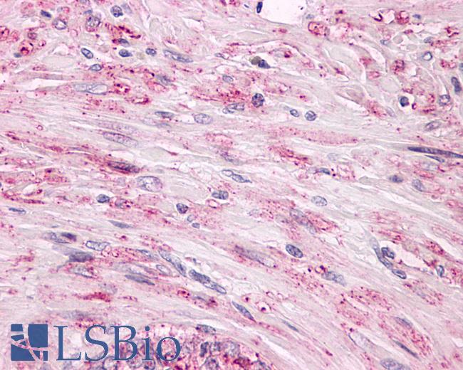 Anti-LPHN2 / Latrophilin-2 antibody IHC of human prostate, smooth muscle, benign prostatic hyperplasia. Immunohistochemistry of formalin-fixed, paraffin-embedded tissue after heat-induced antigen retrieval.