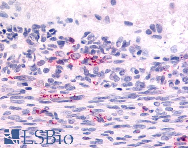 Anti-LPHN2 antibody LS-A1133 IHC of human ovary, Graafian follicle. Immunohistochemistry of formalin-fixed, paraffin-embedded tissue after heat-induced antigen retrieval.