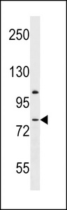 LPHN3 Antibody western blot of mouse spleen tissue lysates (35 ug/lane). The LPHN3 antibody detected the LPHN3 protein (arrow).