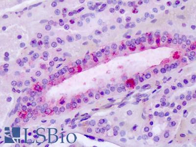 Anti-Latrophilin-3 / LPHN3 antibody IHC of human tonsil. Immunohistochemistry of formalin-fixed, paraffin-embedded tissue after heat-induced antigen retrieval. Antibody LS-A1497 dilution 4-6 ug/ml.