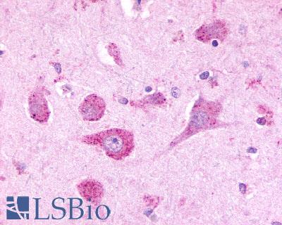 Anti-LPHN3 antibody LS-A1138 IHC of human brain, neurons. Immunohistochemistry of formalin-fixed, paraffin-embedded tissue after heat-induced antigen retrieval.