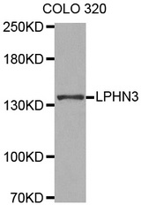 Western blot analysis of extracts of COLO 320 cell lines, using LPHN3 antibody.