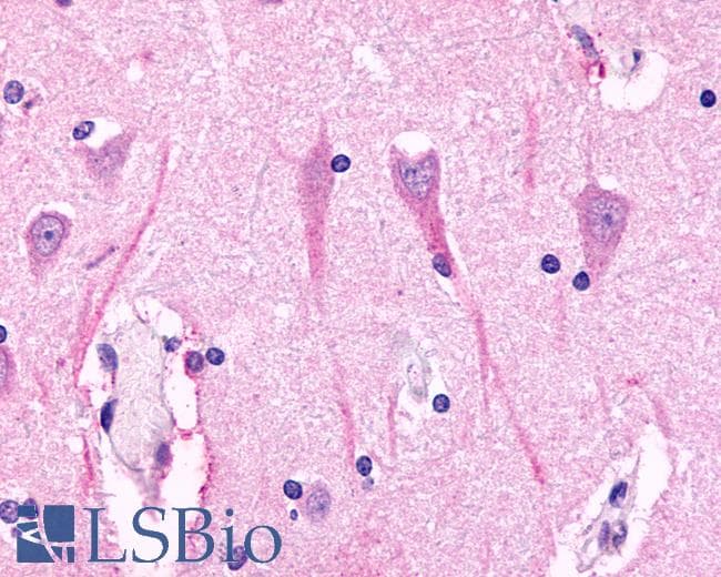 Anti-GPR98 / VLGR1 antibody IHC of human brain, hippocampus. Immunohistochemistry of formalin-fixed, paraffin-embedded tissue after heat-induced antigen retrieval.