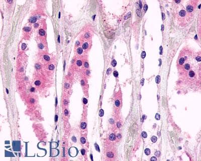 Anti-GPR98 antibody LS-A1727 IHC of human kidney, renal tubules. Immunohistochemistry of formalin-fixed, paraffin-embedded tissue after heat-induced antigen retrieval.