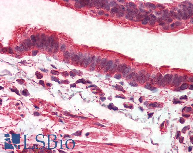 Anti-GPR98 antibody LS-A1728 IHC of human lung, respiratory epithelium. Immunohistochemistry of formalin-fixed, paraffin-embedded tissue after heat-induced antigen retrieval.