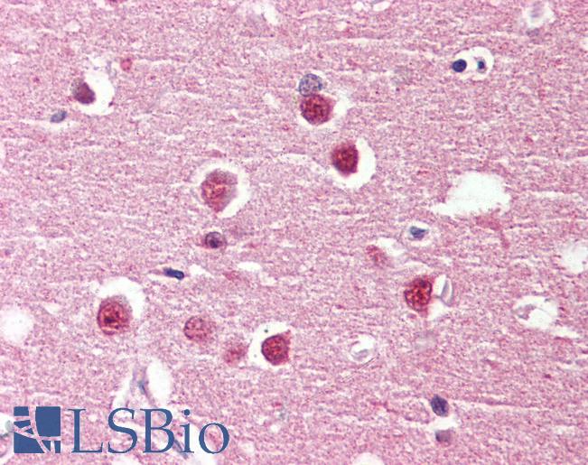 Anti-GPR98 antibody LS-A1728 IHC of human brain, cortex. Immunohistochemistry of formalin-fixed, paraffin-embedded tissue after heat-induced antigen retrieval.