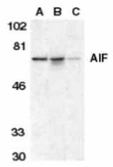 Western blot of AIF in K562 cell lysate (A), mouse (B), and rat (C) liver tissue lysates with AIF antibody at 1 ug/ml.