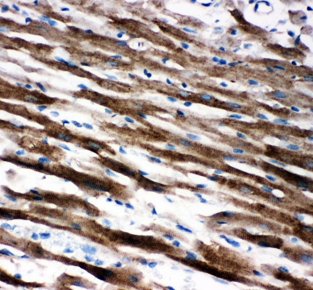 AIFM1 / AIF antibody. IHC(P): Rat Cardiac Muscle Tissue.