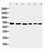 WB of AIFM1 / AIF antibody. Lane 1: Rat Heart Tissue Lysate. Lane 2: Rat Brain Tissue Lysate. Lane 3: K562 Cell Lysate. Lane 4: HEPG2 Cell Lysate. Lane 5: A431 Cell Lysate. Lane 6: NIH3T3 Cell Lysate.