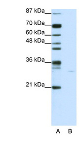 AIFM1 / AIF antibody LS-B1508 Western blot of Jurkat lysate.