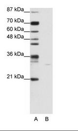 A: Marker, B: Jurkat Cell Lysate