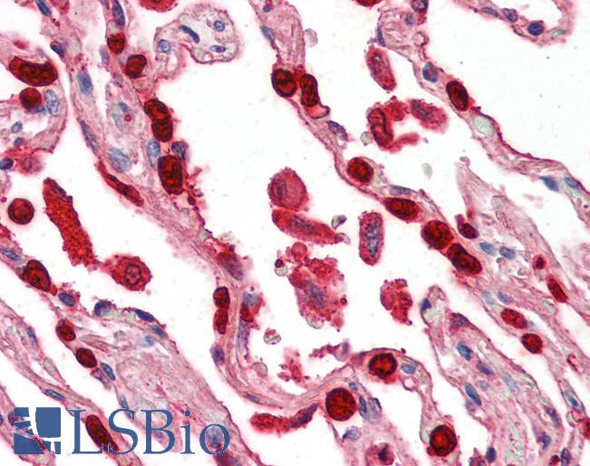 Anti-APRIL antibody IHC of human lung. Immunohistochemistry of formalin-fixed, paraffin-embedded tissue after heat-induced antigen retrieval. Antibody LS-B3191 concentration 5 ug/ml.