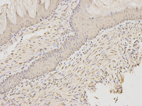Immunohistochemistry of paraffin-embedded rat lung using AIFM1 antibody at dilution of 1:200 (400x lens).