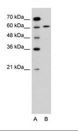 A: Marker, B: Jurkat Cell Lysate