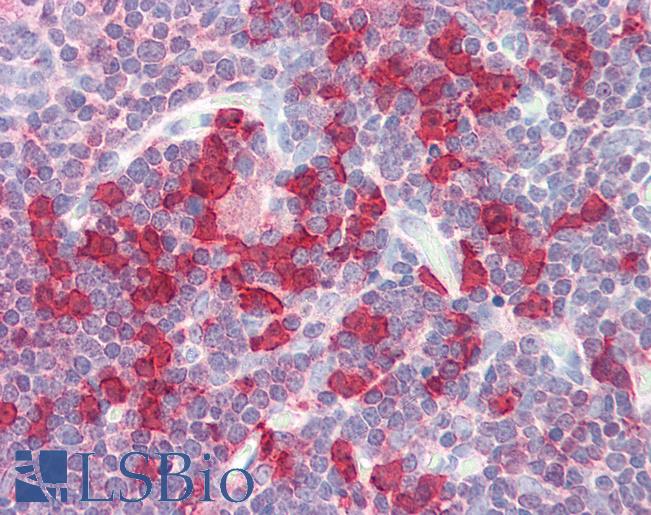 Anti-APRIL antibody IHC of human thymus. Immunohistochemistry of formalin-fixed, paraffin-embedded tissue after heat-induced antigen retrieval. Antibody LS-B3191 concentration 5 ug/ml.