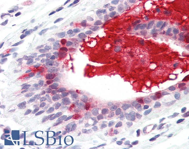 Anti-APRIL antibody IHC of human breast. Immunohistochemistry of formalin-fixed, paraffin-embedded tissue after heat-induced antigen retrieval. Antibody LS-B3191 concentration 5 ug/ml.