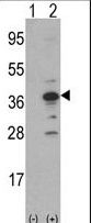 Western blot of MCA1(arrow) using rabbit polyclonal MCA1 Antibody. 293 cell lysates (2 ug/lane) either nontransfected (Lane 1) or transiently transfected with the MCA1 gene (Lane 2) (Origene Technologies).