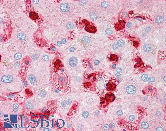 Anti-APRIL antibody IHC of human liver. Immunohistochemistry of formalin-fixed, paraffin-embedded tissue after heat-induced antigen retrieval. Antibody LS-B3191 concentration 5 ug/ml.