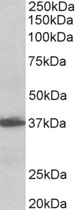 AIMP1 antibody (0.1 ug/ml) staining of Human Lymph Node lysate (35 ug protein in RIPA buffer). Primary incubation was 1 hour. Detected by chemiluminescence.