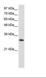 Jurkat Cell Lysate