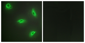 Immunofluorescence of HeLa cells, using TNF14 Antibody. The picture on the right is treated with the synthesized peptide.