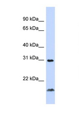 TNFSF14 / LIGHT antibody LS-C112285 Western blot of 721_B Cell lysate. Antibody concentration 1 ug/ml.