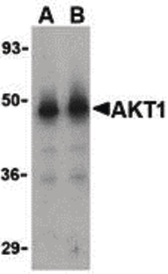 Western blot of Akt1 in human liver cell lysate with Akt1 antibody at (A) 1 and (B) 2 ug/ml.