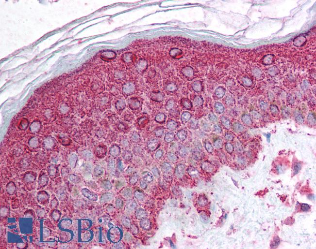 Anti-AKT1 antibody IHC of human skin. Immunohistochemistry of formalin-fixed, paraffin-embedded tissue after heat-induced antigen retrieval. Antibody LS-B1510 concentration 5 ug/ml.