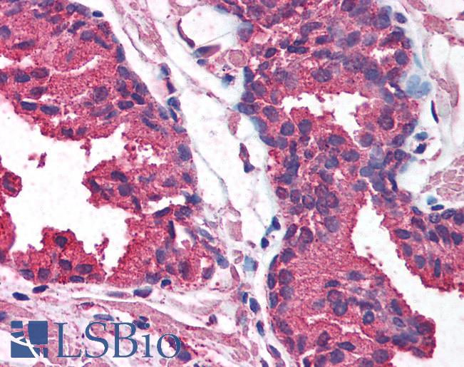 Anti-AKT1 antibody IHC of human prostate. Immunohistochemistry of formalin-fixed, paraffin-embedded tissue after heat-induced antigen retrieval. Antibody LS-B1510 concentration 5 ug/ml.