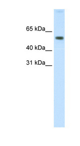 AKT1 antibody LS-B1510 Western blot of Fetal small intestine lysate.