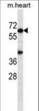 Mouse Akt1 Antibody western blot of mouse heart tissue lysates (35 ug/lane). The Akt1 antibody detected the Akt1 protein (arrow).