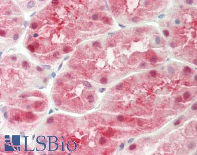 Human Kidney: Formalin-Fixed, Paraffin-Embedded (FFPE)